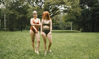 mujeres mostrando piernas con celulitis resistente, asociada a insulina desregulada