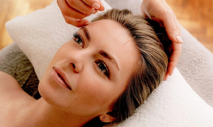 acupuntura estética facial acupuntura estética facial notox en spa