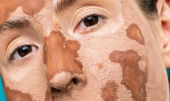 Primer plano de una mujer con mascarilla facial que ilustra la tendencia de usar grasa de vaca en la cara como tratamiento cosmético casero