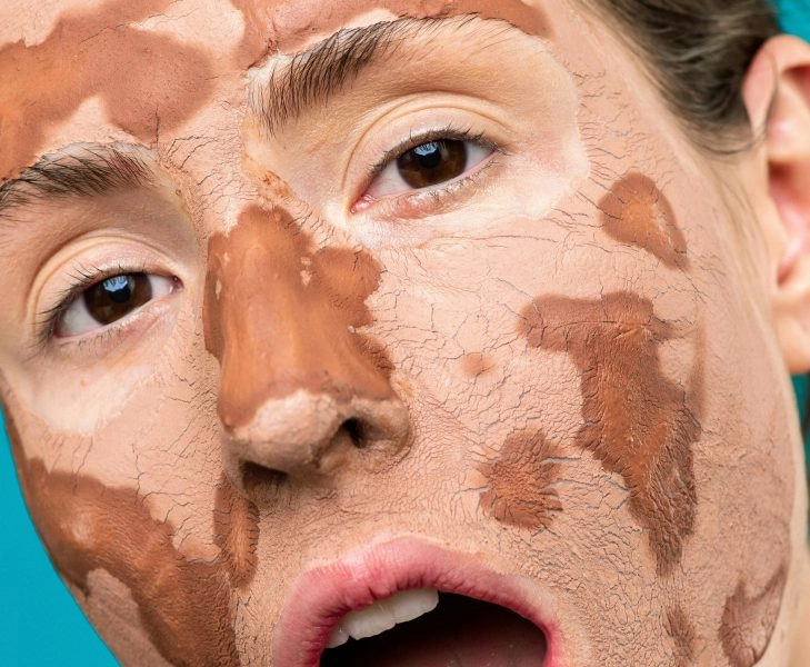 Primer plano de una mujer con mascarilla facial que ilustra la tendencia de usar grasa de vaca en la cara como tratamiento cosmético casero