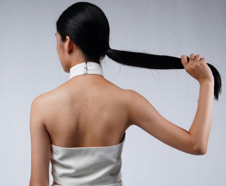 estres-cuero-cabelludo El estrés afecta al cuero cabelludo